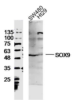SW480 and Ht29 lysates probed with SOX9 Polyclonal Antibody, unconjugated (bs-4177R) at 1:300 overnight at 4\u00b0C followed by a conjugated secondary antibody at 1:10000 for 90 minutes at 37\u00b0C.