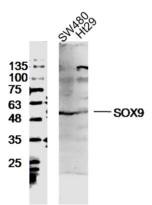 SW480 and Ht29 lysates probed with SOX9 Polyclonal Antibody, unconjugated (bs-4177R) at 1:300 overnight at 4°C followed by a conjugated secondary antibody at 1:10000 for 90 minutes at 37°C.