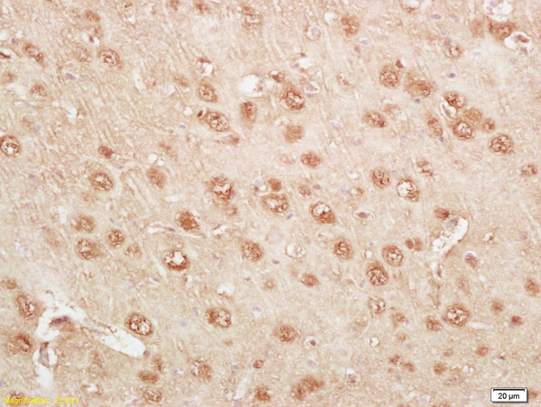 Formalin-fixed and paraffin embedded rat brain tissue labeled Anti-KLK14 Polyclonal Antibody, Unconjugated (bs-1968R) at 1:200, followed by conjugation to the secondary antibody and DAB staining