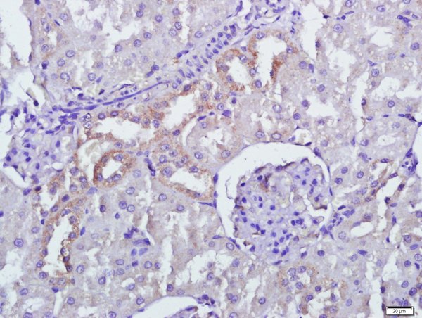 Paraformaldehyde-fixed, paraffin embedded rat kidney tissue; Antigen retrieval by boiling in sodium citrate buffer(pH6) for 15min; Block endogenous peroxidase by 3% hydrogen peroxide for 30 minutes; Blocking buffer (normal goat serum) at 37°C for 20min; Antibody incubation with Rabbit Anti-PERK Polyclonal Antibody, Unconjugated (bs-2469R) at 1:500 overnight at 4°C, followed by a conjugated secondary and DAB staining