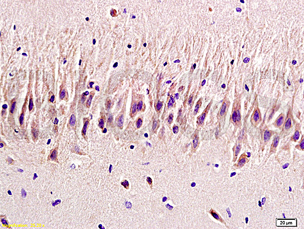 Formalin-fixed and paraffin embedded rat brain labeled with  Rabbit Anti 5-HTR2A\/HTR2A Polyclonal Antibody, Unconjugated (bs-1056R) at 1:200 followed by conjugation to the secondary antibody and DAB staining