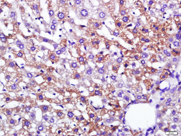 Paraformaldehyde-fixed, paraffin embedded mouse liver; Antigen retrieval by boiling in sodium citrate buffer (pH6) for 15min; Block endogenous peroxidase by 3% hydrogen peroxide for 30 minutes; Blocking buffer (normal goat serum) at 37°C for 20min; Antibody incubation with \tLeptin Polyclonal Antibody, Unconjugated (bs-0108R) at 1:200 overnight at 4°C, followed by a conjugated secondary and DAB staining.