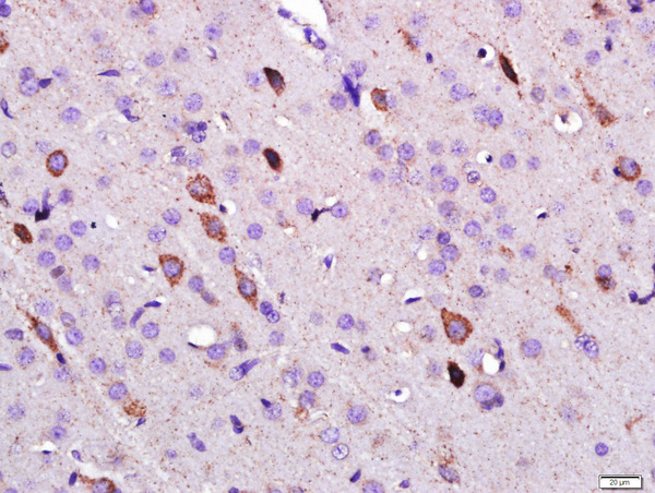 Paraformaldehyde-fixed, paraffin embedded rat brain; Antigen retrieval by boiling in sodium citrate buffer (pH6) for 15min; Block endogenous peroxidase by 3% hydrogen peroxide for 30 minutes; Blocking buffer (normal goat serum) at 37°C for 20min; Antibody incubation with \tLeptin Polyclonal Antibody, Unconjugated (bs-0108R) at 1:500 overnight at 4°C, followed by a conjugated secondary and DAB staining.