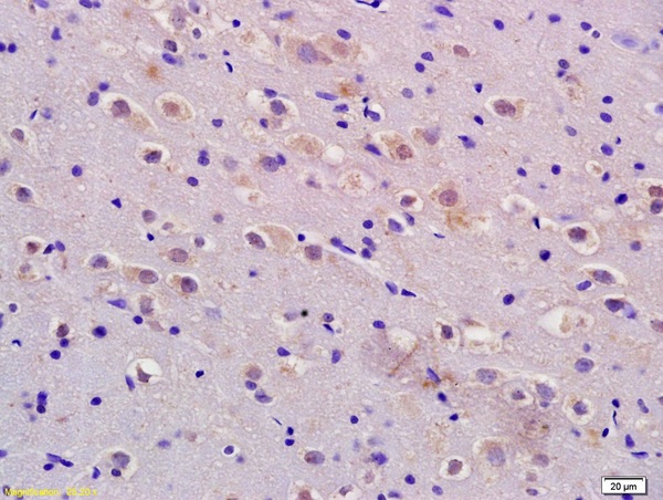 Formalin-fixed and paraffin embedded rat brain labeled with Anti-ADM\/AM\/Adrenomedullin Polyclonal Antibody, Unconjugated (bs-0007R) at 1:200 followed by conjugation to the secondary antibody and DAB staining.