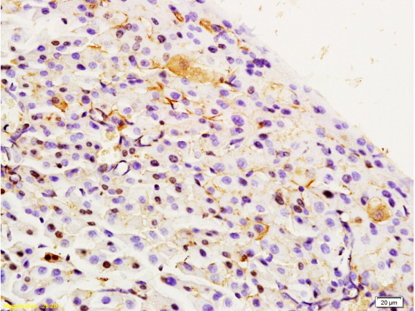 Formalin-fixed and paraffin embedded rat pancreas labeled with Rabbit Anti Integrin Alpha 3 + Beta 1 Polyclonal Antibody, Unconjugated (bs-1057R) at 1:200 followed by conjugation to the secondary antibody and DAB staining