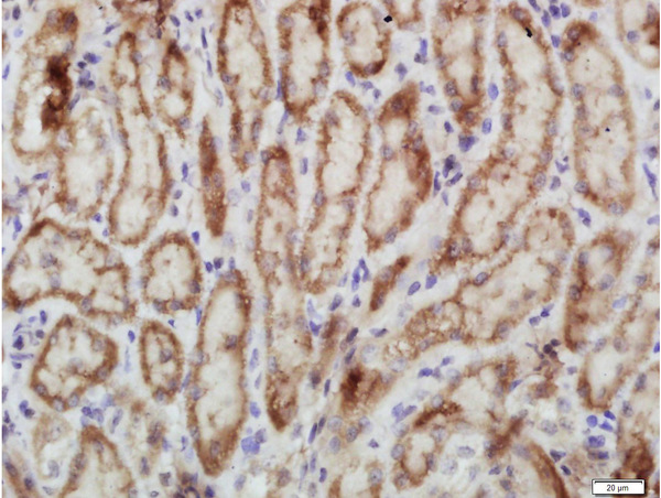 Paraformaldehyde-fixed, paraffin embedded rat kidney tissue; Antigen retrieval by boiling in sodium citrate buffer(pH6) for 15min; Block endogenous peroxidase by 3% hydrogen peroxide for 30 minutes; Blocking buffer (normal goat serum) at 37°C for 20min; Antibody incubation with Rabbit Anti-PERK (Thr980) Polyclonal Antibody, Unconjugated (bs-3330R) at 1:400 overnight at 4°C, followed by a conjugated secondary and DAB staining Paraformaldehyde-fixed, paraffin embedded rat kidney tissue; Antigen retrieval by boiling in sodium citrate buffer(pH6) for 15min; Block endogenous peroxidase by 3% hydrogen peroxide for 30 minutes; Blocking buffer (normal goat serum) at 37°C for 20min; Antibody incubation with Rabbit Anti-PERK (Thr980) Polyclonal Antibody, Unconjugated (bs-3330R) at 1:400 overnight at 4°C, followed by a conjugated secondary and DAB staining