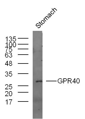 Mouse stomach lysates probed with GPR40 Polyclonal Antibody, unconjugated (bs-13535R) at 1:300 overnight at 4°C followed by a conjugated secondary antibody at 1:10000 for 60 minutes at 37°C.