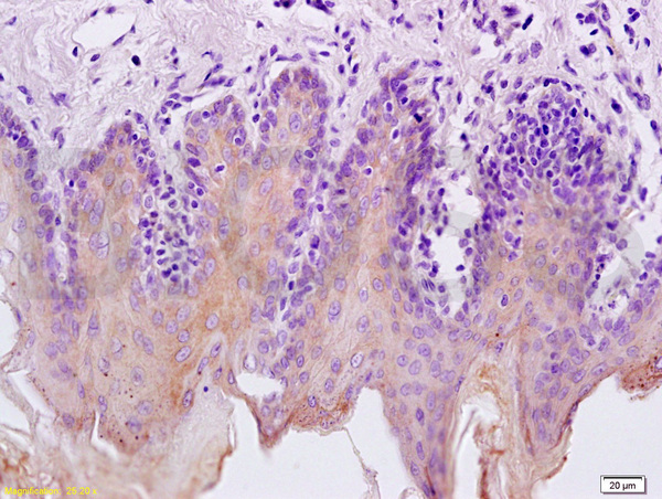 Formalin-fixed and paraffin embedded rat tongue labeled with Rabbit Anti Cytokeratin 5/CK5 Polyclonal Antibody, Unconjugated (bs-1060R) at 1:200 followed by conjugation to the secondary antibody and DAB staining