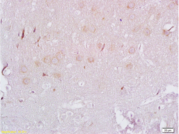Formalin-fixed and paraffin embedded rat brain labeled with Rabbit Anti ADRB3/beta 3 Adrenergic Receptor Polyclonal Antibody, Unconjugated (bs-1063R) at 1:200 followed by conjugation to the secondary antibody and DAB staining Formalin-fixed and paraffin embedded rat brain labeled with Rabbit Anti ADRB3/beta 3 Adrenergic Receptor Polyclonal Antibody, Unconjugated (bs-1063R) at 1:200 followed by conjugation to the secondary antibody and DAB staining