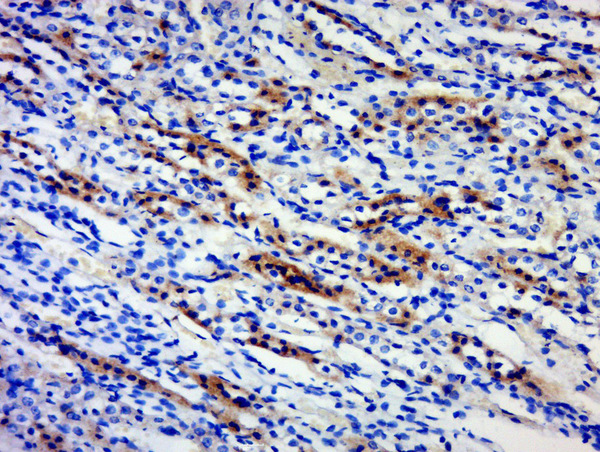 Paraformaldehyde-fixed, paraffin embedded rat kidney; Antigen retrieval by boiling in sodium citrate buffer (pH6) for 15min; Block endogenous peroxidase by 3% hydrogen peroxide for 30 minutes; Blocking buffer (normal goat serum) at 37°C for 20min; Antibody incubation with \tBPTF/FALZ Polyclonal Antibody, Unconjugated (bs-11641R) at 1:500 overnight at 4°C, followed by a conjugated secondary and DAB staining.