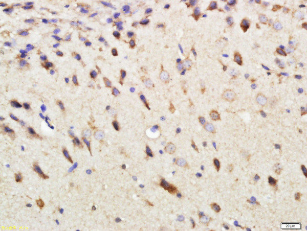 Paraformaldehyde-fixed, paraffin embedded rat brain; Antigen retrieval by boiling in sodium citrate buffer (pH6) for 15min; Block endogenous peroxidase by 3% hydrogen peroxide for 30 minutes; Blocking buffer (normal goat serum) at 37°C for 20min; Antibody incubation with DEPTOR Polyclonal Antibody, Unconjugated (bs-8255R) at 1:500 overnight at 4°C, followed by a conjugated secondary and DAB staining. Paraformaldehyde-fixed, paraffin embedded rat brain; Antigen retrieval by boiling in sodium citrate buffer (pH6) for 15min; Block endogenous peroxidase by 3% hydrogen peroxide for 30 minutes; Blocking buffer (normal goat serum) at 37°C for 20min; Antibody incubation with DEPTOR Polyclonal Antibody, Unconjugated (bs-8255R) at 1:500 overnight at 4°C, followed by a conjugated secondary and DAB staining.