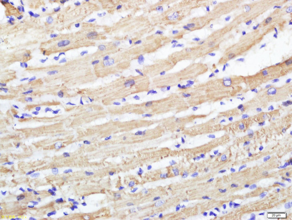 Paraformaldehyde-fixed, paraffin embedded rat heart; Antigen retrieval by boiling in sodium citrate buffer (pH6) for 15min; Block endogenous peroxidase by 3% hydrogen peroxide for 30 minutes; Blocking buffer (normal goat serum) at 37°C for 20min; Antibody incubation with CABC1 Polyclonal Antibody, Unconjugated (bs-8071R) at 1:500 overnight at 4°C, followed by a conjugated secondary and DAB staining.
