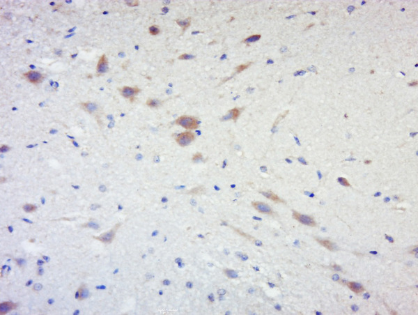 Paraformaldehyde-fixed, paraffin embedded rat brain; Antigen retrieval by boiling in sodium citrate buffer (pH6) for 15min; Block endogenous peroxidase by 3% hydrogen peroxide for 30 minutes; Blocking buffer (normal goat serum) at 37°C for 20min; Antibody incubation with RPS6KB1(Ser441+Thr444) Antibody, Unconjugated (bs-5673R) at 1:200 overnight at 4°C, followed by a conjugated secondary and DAB staining.