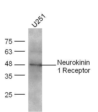U251 lysates probed with Neurokinin 1 Receptor Polyclonal Antibody, unconjugated (bs-0064R) at 1:300 overnight at 4°C followed by a conjugated secondary antibody at 1:10000 for 60 minutes at 37°C.