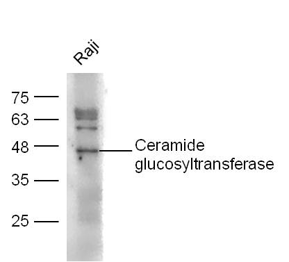 Raji lysates probed with Ceramide glucosyltransferase Polyclonal Antibody, unconjugated (bs-0701R) at 1:300 overnight at 4°C followed by a conjugated secondary antibody at 1:10000 for 60 minutes at 37°C.