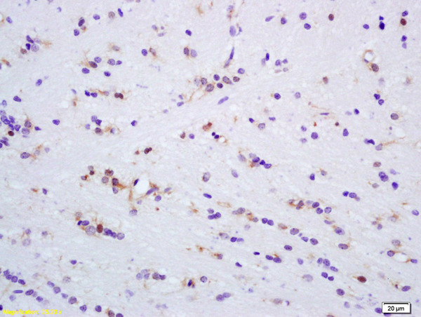 Formalin-fixed and paraffin embedded rat brain tissue labeled Anti-MAPK4 Polyclonal Antibody, Unconjugated (bs-1319R) at 1:200, followed by conjugation to the secondary antibody and DAB staining