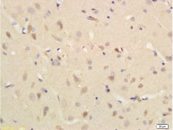 Formalin-fixed and paraffin embedded rat brain tissue labeled with  Rabbit Anti-Substance P Polyclonal Antibody (bs-0065R) 1:200 followed by conjugation to the secondary antibody and DAB staining.