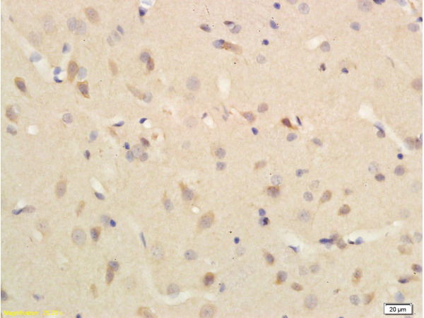 Formalin-fixed and paraffin embedded rat brain tissue labeled with Rabbit Anti-Substance P Polyclonal Antibody (bs-0065R) 1:200 followed by conjugation to the secondary antibody and DAB staining.