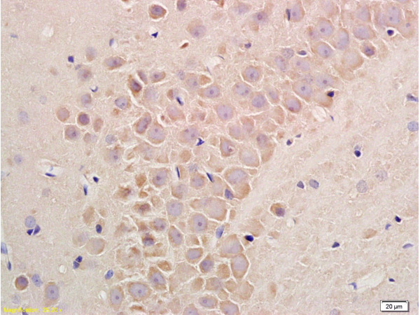 Formalin-fixed and paraffin embedded rat liver tissue labeled with  Rabbit Anti-Substance P Polyclonal Antibody(bs-0065R)at 1:200 followed by conjugation to the secondary antibody and DAB staining.