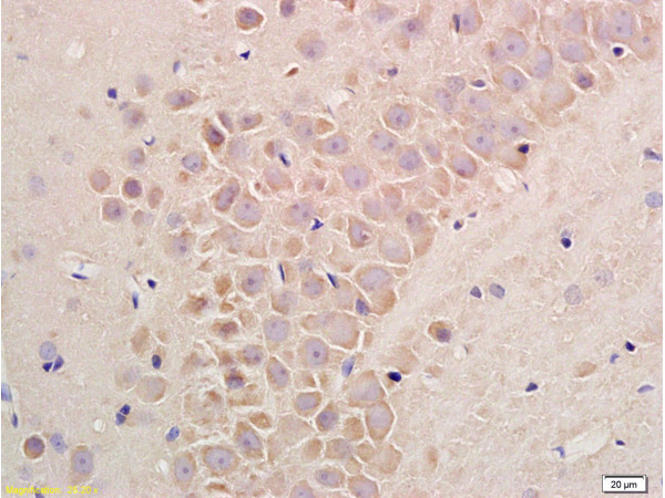 Formalin-fixed and paraffin embedded rat liver tissue labeled with Rabbit Anti-Substance P Polyclonal Antibody(bs-0065R)at 1:200 followed by conjugation to the secondary antibody and DAB staining.