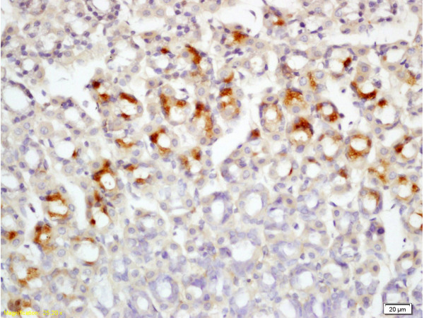 Formalin-fixed and paraffin embedded rat colon tissue labeled with Rabbit Anti-Leptin receptor(long) Polyclonal Antibody (bs-0109R) at 1:200 followed by conjugation to the secondary antibody and DAB staining.