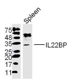 Mouse spleen lysates probed with IL22BP Polyclonal Antibody, unconjugated (bs-2625R) at 1:300 overnight at 4°C followed by a conjugated secondary antibody at 1:10000 for 90 minutes at 37°C.\n