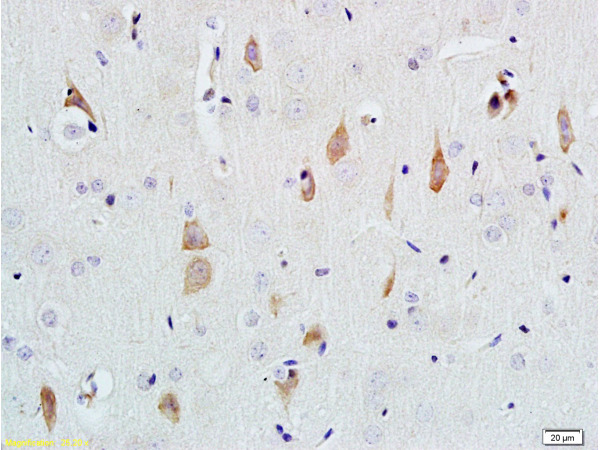 Formalin-fixed and paraffin embedded rat brain tissue labeled with Rabbit Anti-NGF-beta Polyclonal Antibody (bs-0067R) at 1:200 followed by conjugation to the secondary antibody and DAB staining.