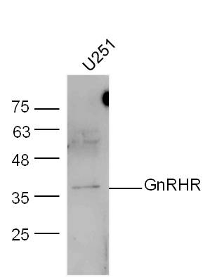 U251 lysates probed with GnRHR Polyclonal Antibody, unconjugated (bs-1464R) at 1:300 overnight at 4°C followed by a conjugated secondary antibody at 1:10000 for 60 minutes at 37°C.