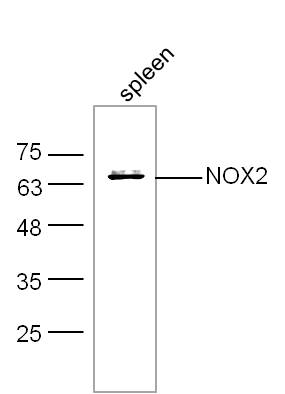 Mouse spleen lysates probed with NOX2/gp91phox Polyclonal Antibody, unconjugated (bs-3889R) at 1:300 overnight at 4°C followed by a conjugated secondary antibody at 1:10000 for 60 minutes at 37°C. Mouse spleen lysates probed with NOX2/gp91phox Polyclonal Antibody, unconjugated (bs-3889R) at 1:300 overnight at 4°C followed by a conjugated secondary antibody at 1:10000 for 60 minutes at 37°C.