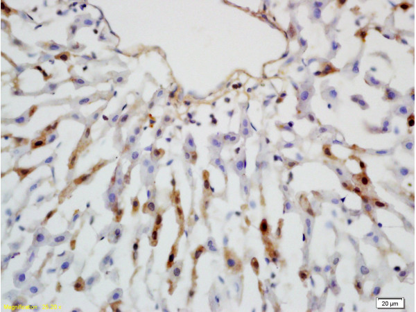 Formalin-fixed and paraffin embedded rat colon tissue labeled with Rabbit Anti-Leptin receptor(long) Polyclonal Antibody (bs-0109R) at 1:200 followed by conjugation to the secondary antibody and DAB staining