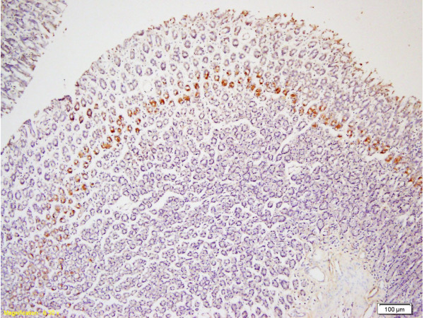 Formalin-fixed and paraffin embedded rat colon tissue labeled with Rabbit Anti-Leptin receptor(long) Polyclonal Antibody (bs-0109R) at 1:200 followed by conjugation to the secondary antibody and DAB staining.