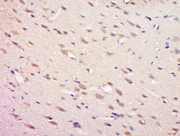 Paraformaldehyde-fixed, paraffin embedded rat brain tissue; Antigen retrieval by boiling in sodium citrate buffer(pH6) for 15min; Block endogenous peroxidase by 3% hydrogen peroxide for 30 minutes; Blocking buffer (normal goat serum) at 37°C for 20min; Antibody incubation with Rabbit Anti-SHP2 (Tyr81) Polyclonal Antibody, Unconjugated (bs-5638R) at 1:500 overnight at 4°C, followed by a conjugated secondary and DAB staining