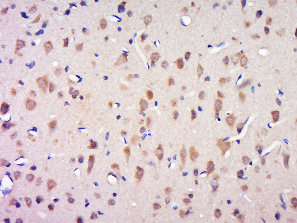 Paraformaldehyde-fixed, paraffin embedded rat brain tissue; Antigen retrieval by boiling in sodium citrate buffer(pH6) for 15min; Block endogenous peroxidase by 3% hydrogen peroxide for 30 minutes; Blocking buffer (normal goat serum) at 37°C for 20min; Antibody incubation with Rabbit Anti-CCDC124 Polyclonal Antibody, Unconjugated (bs-8083R) at 1:500 overnight at 4°C, followed by a conjugated secondary and DAB staining