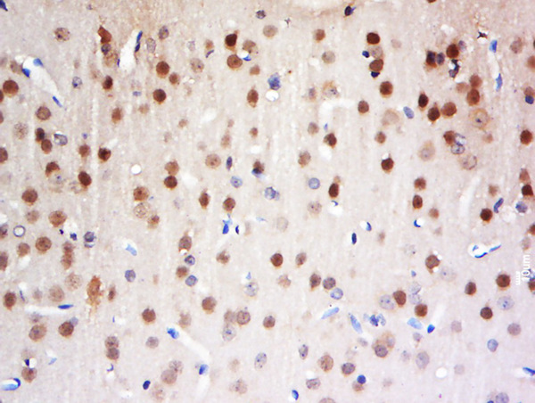Paraformaldehyde-fixed, paraffin embedded rat brain tissue; Antigen retrieval by boiling in sodium citrate buffer(pH6) for 15min; Block endogenous peroxidase by 3% hydrogen peroxide for 30 minutes; Blocking buffer (normal goat serum) at 37°C for 20min; Antibody incubation with Rabbit Anti-FAM13C1 Polyclonal Antibody, Unconjugated (bs-8215R) at 1:500 overnight at 4°C, followed by a conjugated secondary and DAB staining