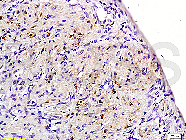 Formalin-fixed and paraffin embedded rat uterine myoma labeled with Rabbit Anti-ER-beta Polyclonal Antibody (bs-0166R) at 1:200 followed by conjugation to the secondary antibody and DAB staining.