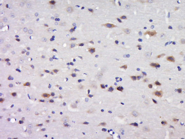 Paraformaldehyde-fixed, paraffin embedded rat brain tissue; Antigen retrieval by boiling in sodium citrate buffer(pH6) for 15min; Block endogenous peroxidase by 3% hydrogen peroxide for 30 minutes; Blocking buffer (normal goat serum) at 37°C for 20min; Antibody incubation with Rabbit Anti-C17orf42 Polyclonal Antibody, Unconjugated (bs-9639R) at 1:500 overnight at 4°C, followed by a conjugated secondary and DAB staining