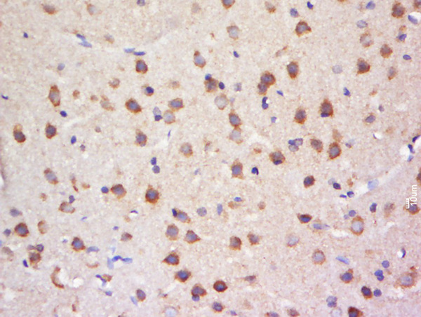 Paraformaldehyde-fixed, paraffin embedded rat brain tissue; Antigen retrieval by boiling in sodium citrate buffer(pH6) for 15min; Block endogenous peroxidase by 3% hydrogen peroxide for 30 minutes; Blocking buffer (normal goat serum) at 37°C for 20min; Antibody incubation with Rabbit Anti-SULT4A1 Polyclonal Antibody, Unconjugated (bs-11763R) at 1:500 overnight at 4°C, followed by a conjugated secondary and DAB staining