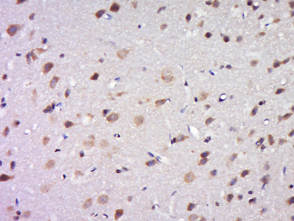 Paraformaldehyde-fixed, paraffin embedded rat brain tissue; Antigen retrieval by boiling in sodium citrate buffer(pH6) for 15min; Block endogenous peroxidase by 3% hydrogen peroxide for 30 minutes; Blocking buffer (normal goat serum) at 37°C for 20min; Antibody incubation with Rabbit Anti-DPAGT1 Polyclonal Antibody, Unconjugated (bs-14412R) at 1:500 overnight at 4°C, followed by a conjugated secondary and DAB staining