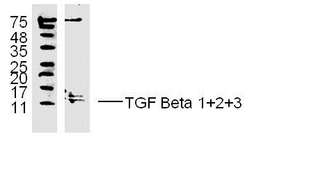 MDA-MB-231 lysates probed with TGF Beta 1+2+3 Polyclonal Antibody, unconjugated (bs-4538R) at 1:300 overnight at 4\u00b0C followed by a conjugated secondary antibody at 1:10000 for 60 minutes at 37\u00b0C.