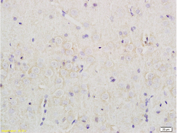Formalin-fixed and paraffin embedded rat brain tissue labeled with  Rabbit Anti-Nociceptin receptor Polyclonal Antibody (bs-0181R) at 1:200 followed by conjugation to the secondary antibody and DAB staining.