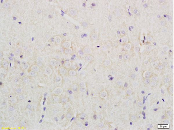 Formalin-fixed and paraffin embedded rat brain tissue labeled with Rabbit Anti-Nociceptin receptor Polyclonal Antibody (bs-0181R) at 1:200 followed by conjugation to the secondary antibody and DAB staining.