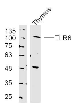 Mouse thymus lysates probed with TLR6 Polyclonal Antibody, unconjugated (bs-2716R) at 1:300 overnight at 4\u00b0C followed by a conjugated secondary antibody at 1:10000 for 90 minutes at 37\u00b0C.