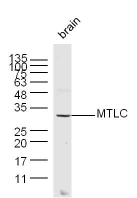 Mouse brain lysates probed with MTLC Polyclonal Antibody, unconjugated (bs-0334R) at 1:300 overnight at 4°C followed by a conjugated secondary antibody at 1:10000 for 60 minutes at 37°C.