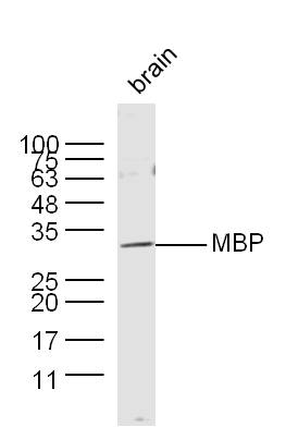 Mouse brain lysates probed with MBP Polyclonal Antibody, unconjugated (bs-0380R) at 1:300 overnight at 4\u00b0C followed by a conjugated secondary antibody at 1:10000 for 60 minutes at 37\u00b0C.