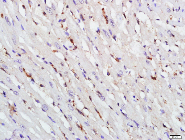 Paraformaldehyde-fixed, paraffin embedded rat heart; Antigen retrieval by boiling in sodium citrate buffer (pH6.0) for 15min; Block endogenous peroxidase by 3% hydrogen peroxide for 20 minutes; Blocking buffer (normal goat serum) at 37°C for 30min; Antibody incubation with TAZ Polyclonal Antibody, Unconjugated (bs-12367R) at 1:400 overnight at 4°C, followed by a conjugated secondary for 20 minutes and DAB staining.