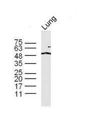 Lane 1: mouse lung lysates probed with \tTAZ Polyclonal Antibody, Unconjugated (bs-12367R) at 1:300 overnight at 4˚C. Followed by a conjugated secondary antibody at 1:10000 for 90 min at 37˚C. Lane 1: mouse lung lysates probed with \tTAZ Polyclonal Antibody, Unconjugated (bs-12367R) at 1:300 overnight at 4˚C. Followed by a conjugated secondary antibody at 1:10000 for 90 min at 37˚C.