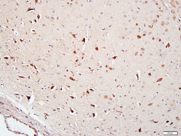 Paraformaldehyde-fixed, paraffin embedded Mouse Brain tissue; Antigen retrieval by boiling in sodium citrate buffer(pH6) for 15min; Block endogenous peroxidase by 3% hydrogen peroxide for 20 minutes; Blocking buffer (normal goat serum) at 37°C for 30min; Antibody incubation with FAM134B Polyclonal Antibody, Unconjugated (bs-13136R) at 1:400 overnight at 4°C, followed by a conjugated secondary and DAB staining
