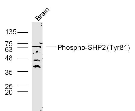 Rat brain lysates probed with SHP2 (Tyr81) Polyclonal Antibody, unconjugated (bs-5638R) at 1:300 overnight at 4°C followed by a conjugated secondary antibody at 1:10000 for 90 minutes at 37°C.