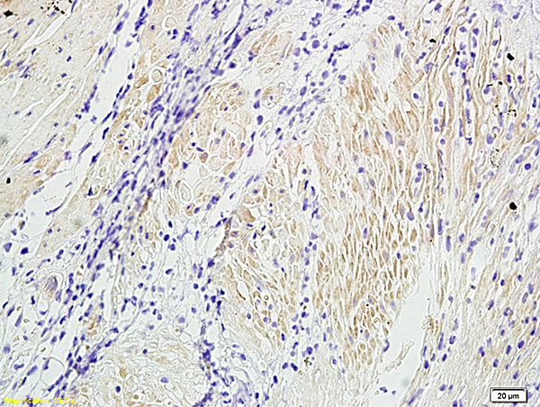 Formalin-fixed and paraffin embedded dog bladder labeled with  Anti-Alpha-SMA Polyclonal Antibody, Unconjugated (bs-0189R)  at 1:300 followed by conjugation to the secondary antibody and DAB staining