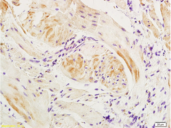 Formalin-fixed and paraffin embedded: dog bladder tissue labeled with Anti-Actin A\/Alpha SMA  Polyclonal Antibody, Unconjugated (bs-0189R) at 1:300, followed by conjugation to the secondary antibody.